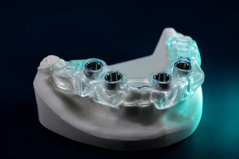Chirurginis implantacijos gidas su atraminėmis įvorėmis